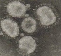 Micrografia eletrônica de um vírus de Bronquite Infecciosa